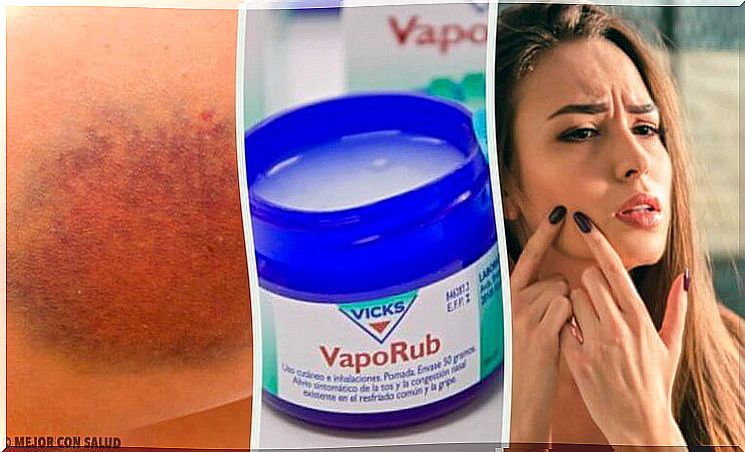 11 surprising ways to use Vicks VapoRub