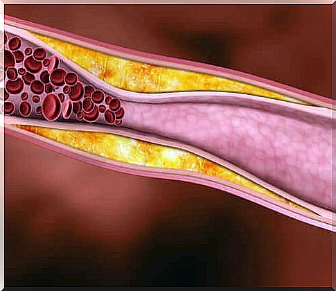 5 cholesterol-lowering healthy fats