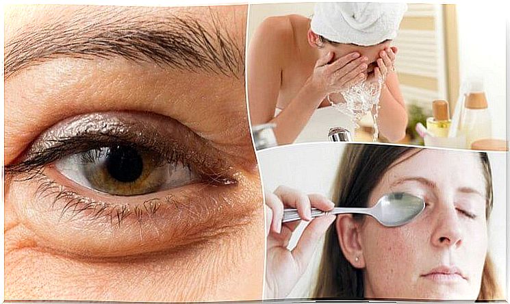 6 natural ways to fade eye bags