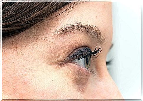 natural treatments to fade eye bags