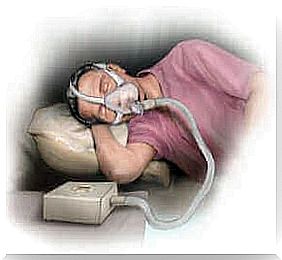 sleep apnea treatment