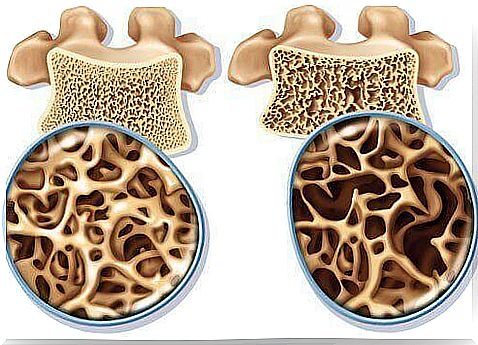 Prevention of osteoporosis with natural calcium supplements