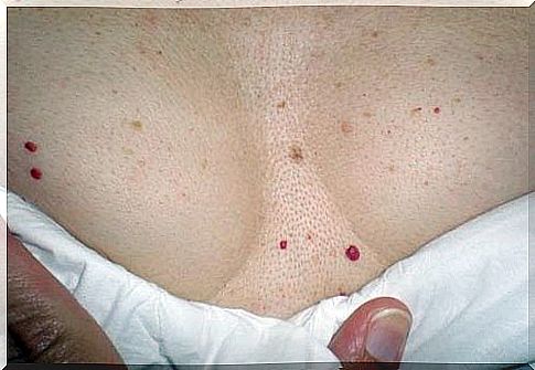 Red dots on the skin - are they a danger?