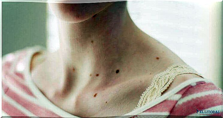 eyelids on a woman's neck