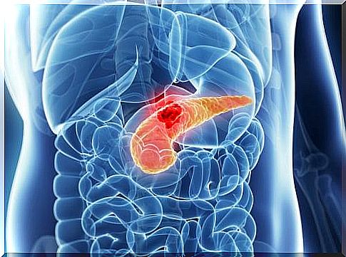 There are different types of pancreatic cancers