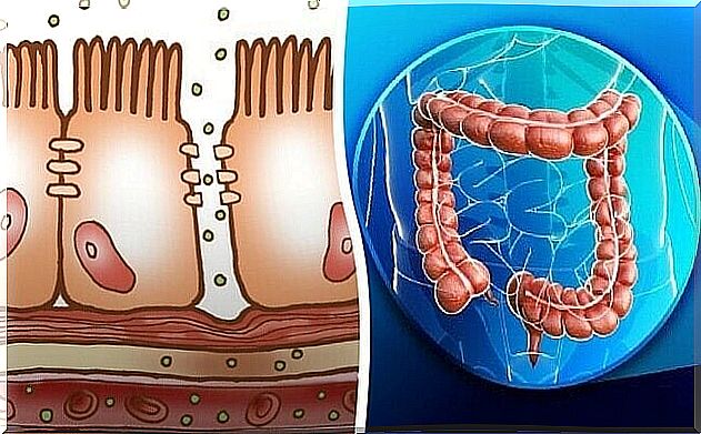 colonic lint