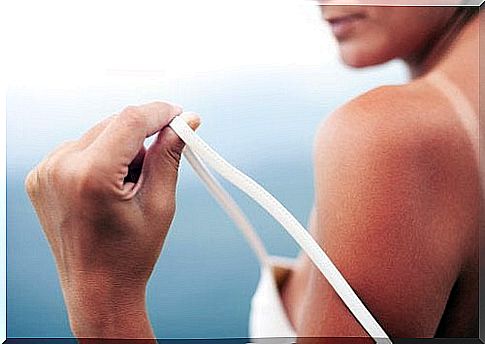 Treat your sunburned skin with these 5 natural treatments