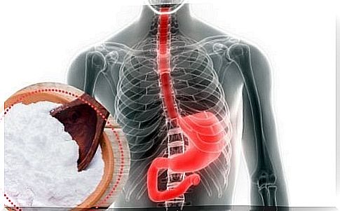 Treatment of heartburn with baking soda