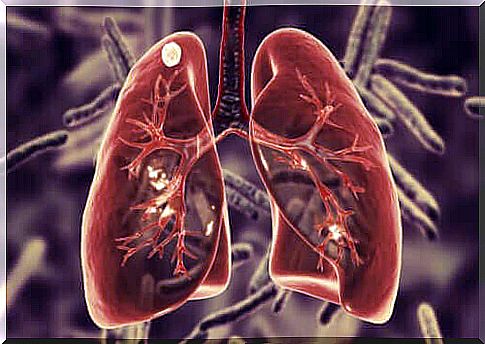 What is pulmonary tuberculosis and what are its symptoms?